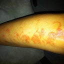 3 days after