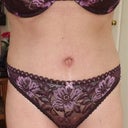 Day 19 Post Op - think I look bigger here than day 12 pic ??