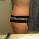 6 weeks post op