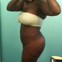 left side - 3 weeks post op