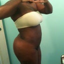 right side - 3 weeks post op