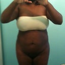 front view.  stil swollen.... love handles going in some... - 3 weeks post op.  ( i keep telling myself 'patience child')