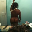 back - 3 weeks post op.  still very swollen in back scoop area and a little tender to touch. - 3 weeks post op