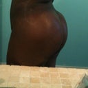butt close view - 3 weeks post op