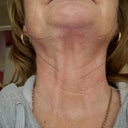 Neck bands do not look attached.