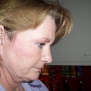 Right side with head tipped. Looser skin along the jawline