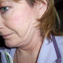 Later sweep on left side of face with head slightly tipped forward.