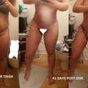 not a huge difference with inner thigh....;( hopefully it will improve with exersise