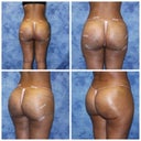 4 of 6 collages I showed dr. P. dr.perry patient.