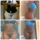 5 of 6 collages I showed dr. P. love the hips, reesyvaughn, salhauzer patient.