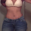2 months post op
