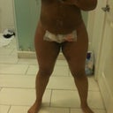 FRT - after lipo