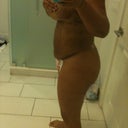 SIDE - after lipo - day 4