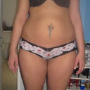 Front veiw before lipo suction