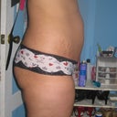 Side veiw