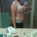 1 day after