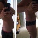 Before and after 3 days post op
