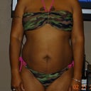 Before Front view