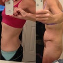 Left: Before and flat, Right: After, 3 weeks and my baby bump, not sure I was that round even at 5 months prego