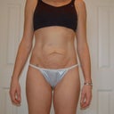 Pre Op - March 19th