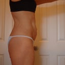 Pre Op - March 19th