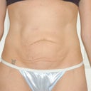 Pre Op - March 19th