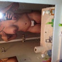 10 days post op