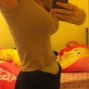 2 months post op