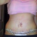 6dayPO