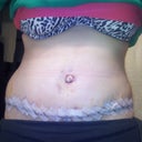 7day PO