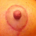 Close up of right breast at 38 days post op.  The tiny white spots are stitches starting to spit.