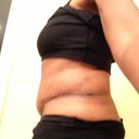 6.5 weeks PO side view