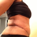 6.5 weeks PO right side view w/dog ears