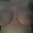 Just seeing how bad these look make me have no doubts about this surgery!