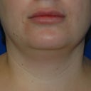 Front view, pictures taken in doctors office.