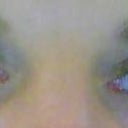 after eyelid surgery 2 mos, still a little puffiness in left eyelid