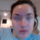 Week 3 and a half...skin has NOT improved and is still in "initial purge/break out" period. :(