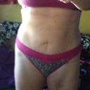 Look Ma, no scar!