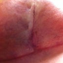 Right side underneath.  Same here .  4 weeks