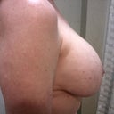 Right side before explant