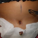 NEW LITTLE BELLY BUTTON!