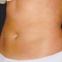 R oblique 8 weeks later