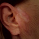 This is what I'm left with after He fixed it and now won't respond to my messages. My ear's cold and painful 24/7 and he did this is January 09 for the last time.