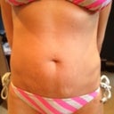 PREOP