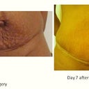 stomach