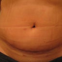 the scar 4 weeks