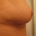 4 weeks other girl look how perky I am now yahoo!!!