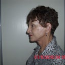 5 weeks post-op....after beauty shop....side view