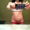 2 weeks post op