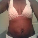 Bikini pre-op